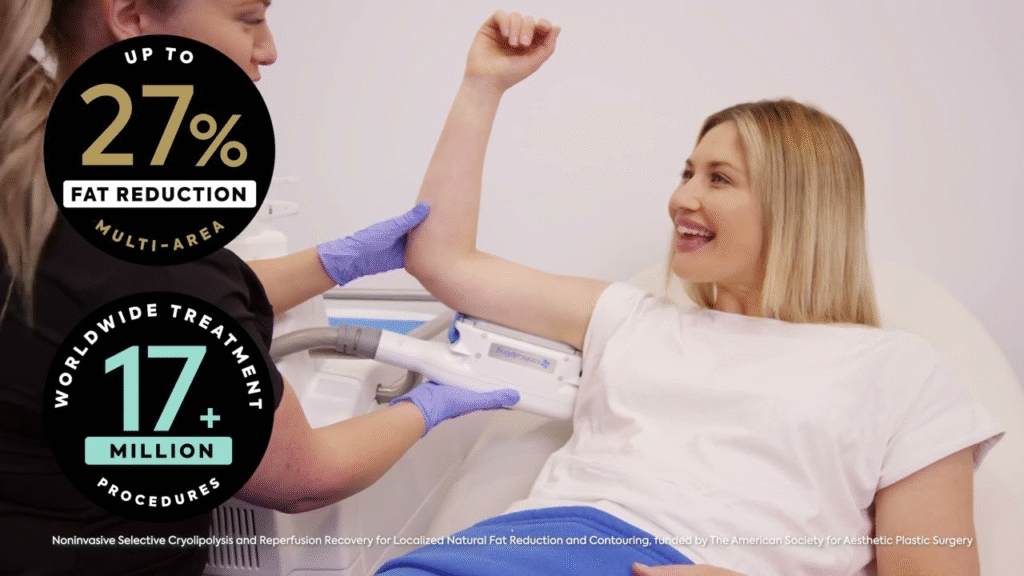 CoolSculpting